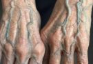 📹 If your veins are visible in your hand, it is a signal of ca…